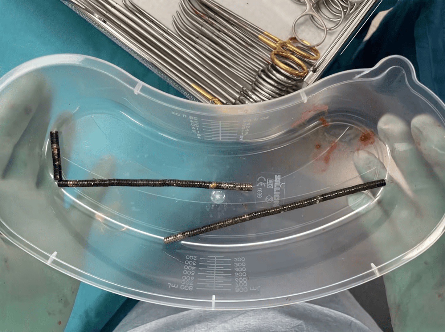 皇冠信用網出租代理
_腹痛4天后送医皇冠信用網出租代理
，新西兰男孩吞下约100颗磁铁致肠道坏死 医生切除部分肠组织